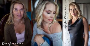 Zepne-Before-and-after-web